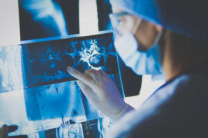 Come riconoscere i primi segnali del cancro: breve guida