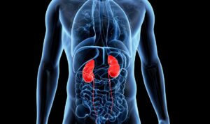 Infarto renale: sintomi, diagnosi, trattamenti