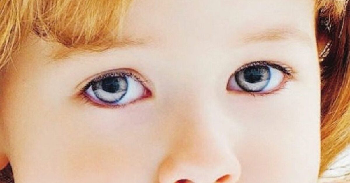 Sindrome di Rett, l'Università di Trieste coordina sperimentazione ...