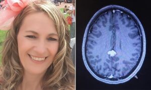 Dimenticava i nomi e pensava fosse la menopausa: aveva un tumore al cervello