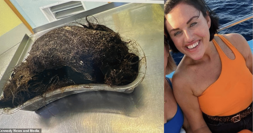 La massa di capelli e la madre della 14enne.