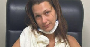 Bella Hadid e la sua battaglia silenziosa contro la malattia di Lyme