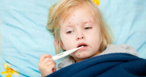 Morbillo: i primi sintomi che ogni genitore deve conoscere