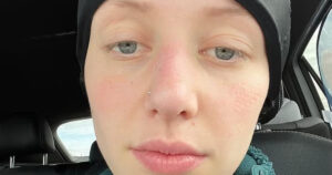 “Era solo ansia”: ma Kelsey aveva un tumore al cervello