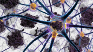 Alzheimer, una proteina “aspirapolvere” potrebbe rallentare la malattia