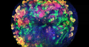 Quando i mini‑reni aprono la strada ai trapianti: ecco come