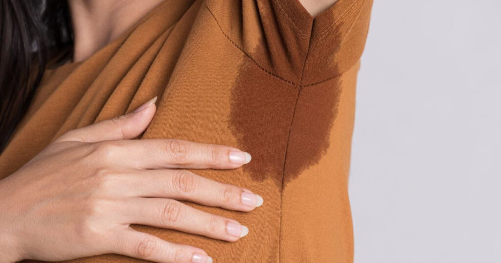 Quando sudare troppo è un problema: tutto sull’iperidrosi