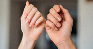 Le tue unghie parlano: 5 segnali d’allarme che il corpo ti invia (e che ignori)