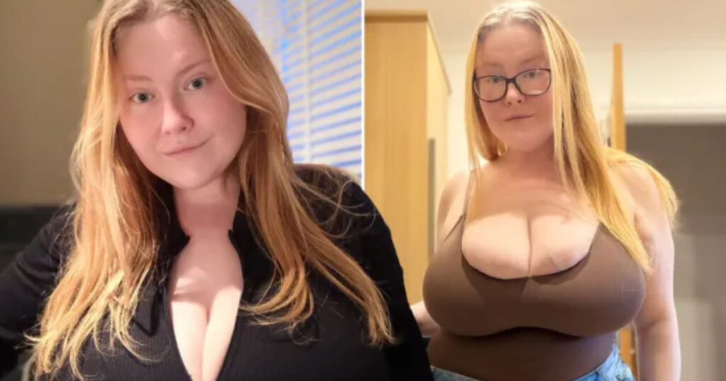 Un seno che cresce mentre il corpo dimagrisce: la diagnosi che sorprende