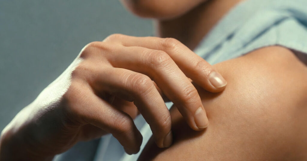 Prurito e ansia: come capire se sono collegati e cosa fare