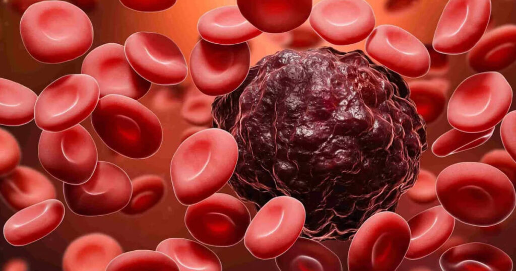 I 3 comportamenti che i medici collegano ai tumori del sangue
