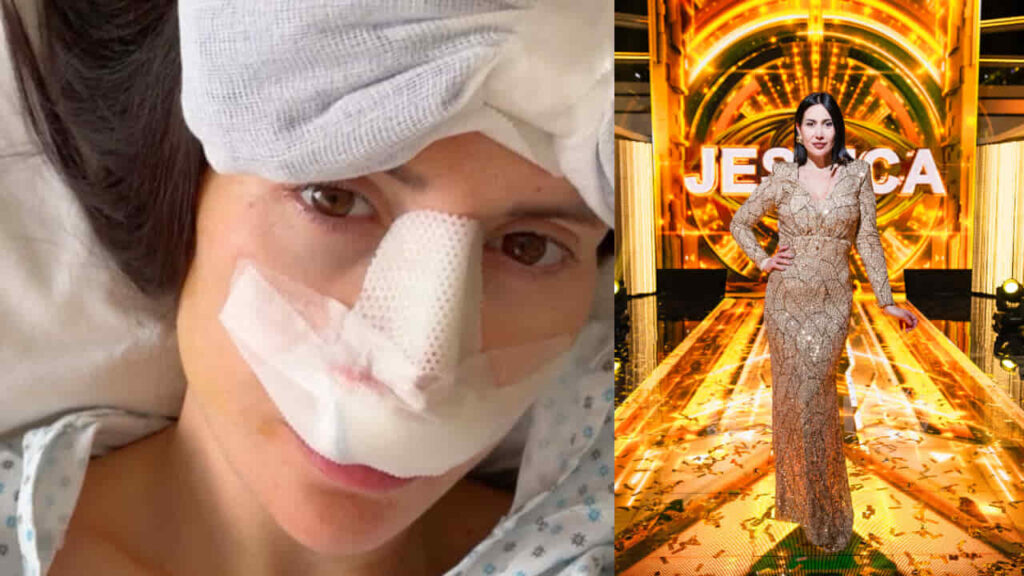 Jessica Morlacchi operata al naso per la quinta volta: “Spero di tornare a respirare con tutte e due le narici”