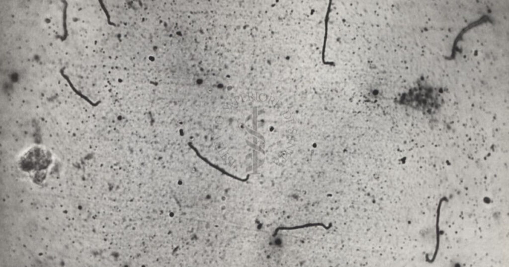 Leptospirosi, cos’è la malattia dei casi a Zante: sintomi e come si prende