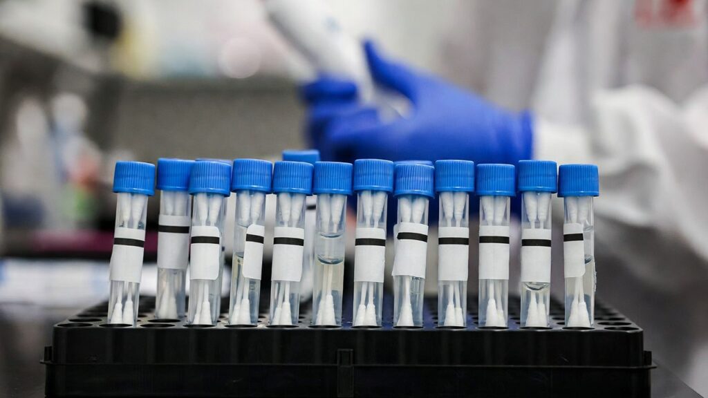 Difterite a Palermo, dieci positivi tra i familiari della bimba morta: stanno bene perché vaccinati